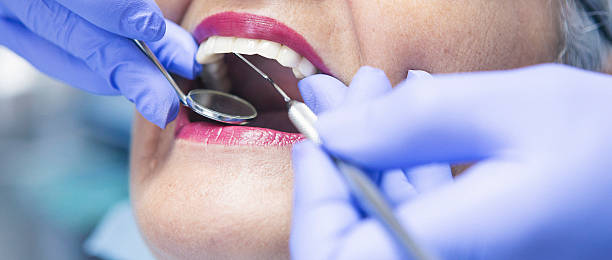 Best Dentist for Tooth Abscess  in Rockdale, IL
